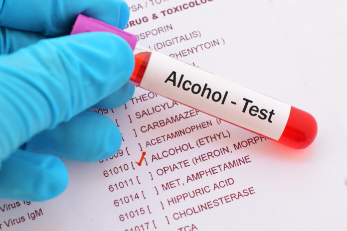 Alcohol bloed test_Jarun Ontakrai SLASH shutterstock_730799647